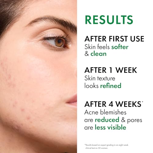 VICHY Normaderm Acne Control Daily Moisturizer with Salicylic Acid 1.7 Fl Oz (Pack of 1) Face Moisturizer