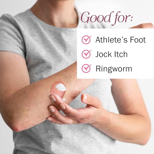 Clotrimazole Antifungal Cream for Skin - 2 Pack with 4 oz. of Clotrimazole Cream for Jock Itch, Athletes Foot Treatment, and More