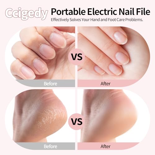 Ccigedy Cordless Electric Toe Nail Grinder for Thick Toenails with LCD Lamp Pink
