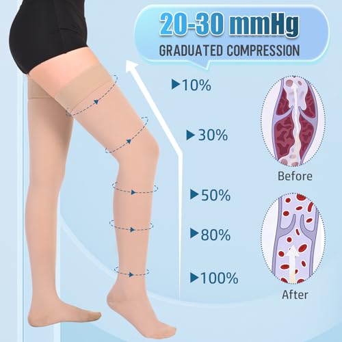 Athbavib 20-30 mmHg Thigh High Compression Stockings for Women Men Large Closed Toe-Beige