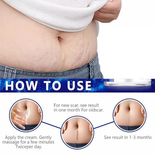 Advanced Scar Gel for Surgical Scars, Face, Body, Legs, Burns, Acne, C-Section, Stretch Marks, Keloids - Effective Scar Removal for Men and Women, Suitable for Old & New Scars (100% New -1 Bottle) 100% New -1 Bottle