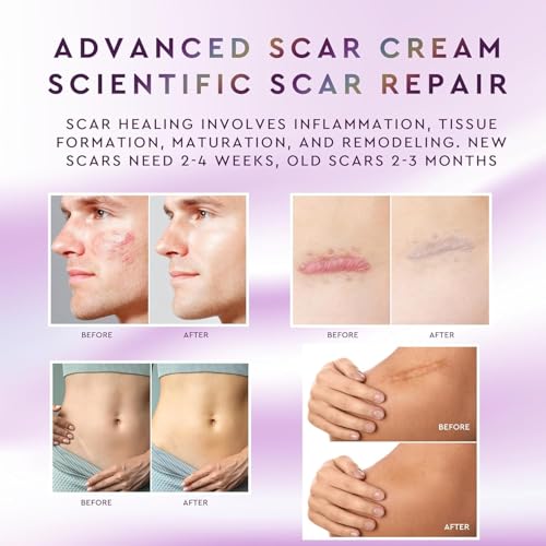 Advanced Silicone Scar Removal Cream – Professional Keloid Scar Treatment, Surgical Scars, C-Section, Hysterectomy, Mastectomy, Tummy Tuck, Acne Marks & Keloid Bump Removal Treatment – 30g 1 pack
