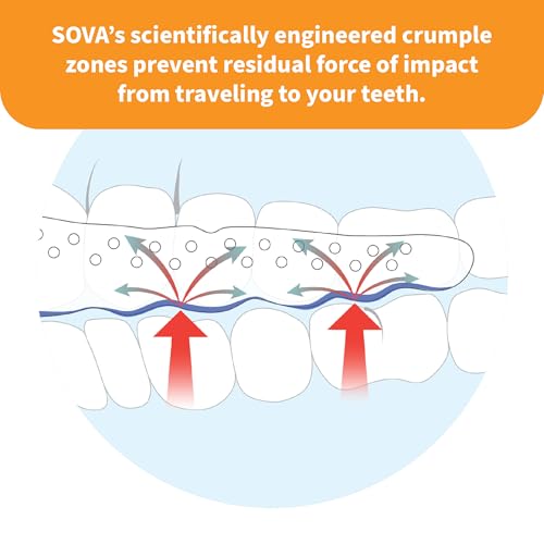 SOVA Junior Night Guard with Case, Spring Green - 1.6mm Thin - Custom-Molded Fit - Protects Against Nighttime Teeth Grinding & Clenching - Odor & Taste Free - Remoldable Up to 20 Times - Non Toxic