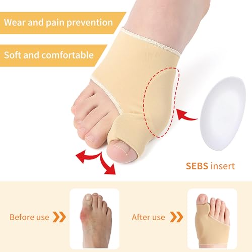 2 pairs Bunion Toe Corrector Big Toe Spacer Separators Brace Straighteners Non-Slip Orthopedic Bunion Splint Comfortable Breathable Toe Guard Fix Bunion Socks Relief Pain in Hallux Valgus beige Medium