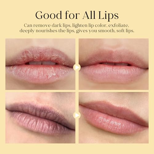 Turmeric Lip Treatment Kit for Dark Lips, Lip Scrub&Lip Balm for Smokers, Lip Exfoliator Scrub for Hydration Chapped and Cracked Peel Lips 1x Turmeric Lip Balm, 1x Turmeric Lip Scrub