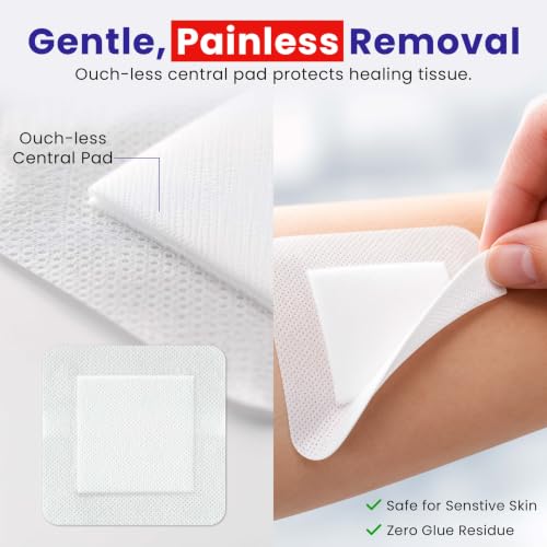 HEALQU Island Dressing - 4"x4", 30 Count - Bordered Gauze Sterile Individually Wrapped Gauze Pads, Water-Resistant, Non-Woven Backing - Soft and Breathable Wound Dressing for First Aid and Medical 4x4" (2.5x2.5" pad) Box of 30