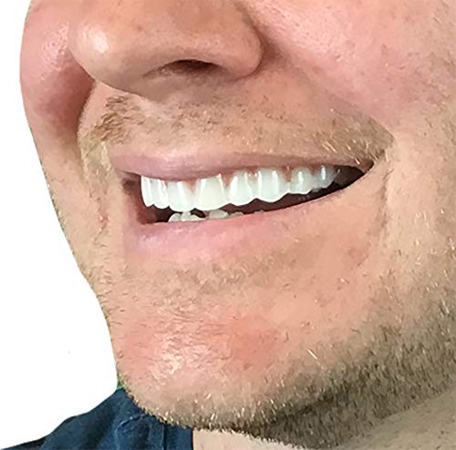 Instant Smile Comfort Fit Flex Cosmetic Teeth, Natural Shade, Upper 1 Count (Pack of 1)