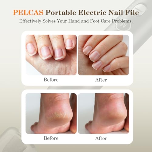 PELCAS Electric Nail Grinder, 10 Speeds Cordless Nail Drill with LED Light Grey