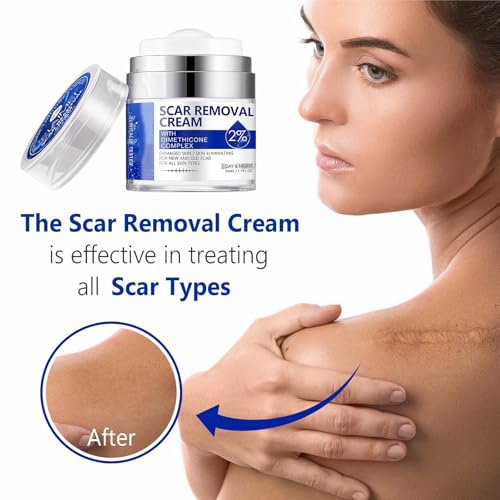 Scar Cream, Scar Removal Cream - Advanced Scar Cream for Surgical Scars, Acne Scars, C-Section, Burns, Stretch Marks -Effective for Old and New Scars Gel Acne Scar Treatment