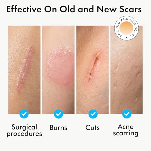 Serica Scar Gel, Silicone Formula for Scars, Face Safe, Quick-Dry, 1 oz