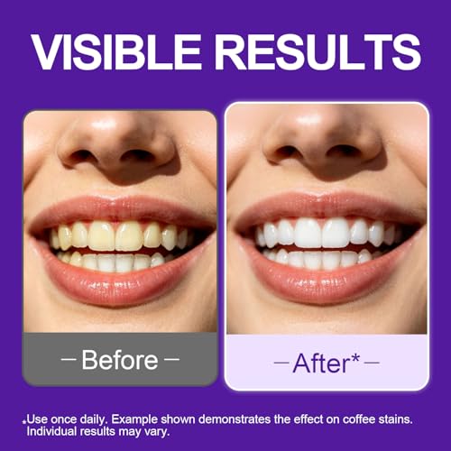 Teeth whitening Strips, Pap Formula Purple Whitening, Gentle Formula 2 Count (Pack of 28)