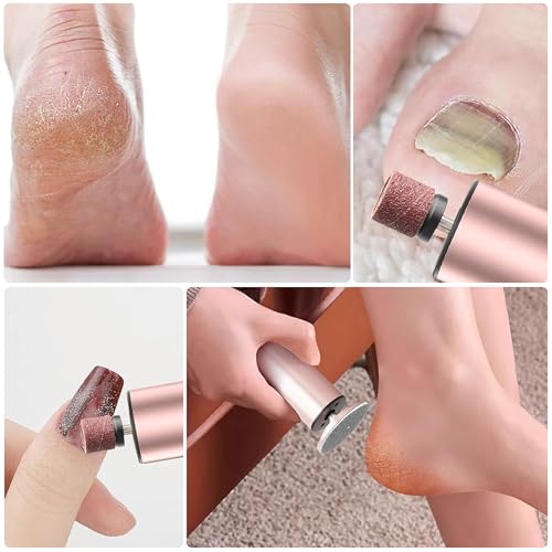 Rechargeable Electric Foot Callus Remover, Pedicure Tools for Feet, Electric Foot File, Heel Scraper for Cracked Heels, Calloused Feet Remover Tool (Pink) Pink