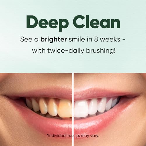 MySmile Fluoride Free Nano Hydroxyapatite Toothpaste for Sensitive Teeth, Strengthens Enamel, Remineralizes & Whitens Teeth, Freshens Breath for Adults, SLS Free, Misty Mint, 4.2 oz 4.2 Ounce (Pack of 3)