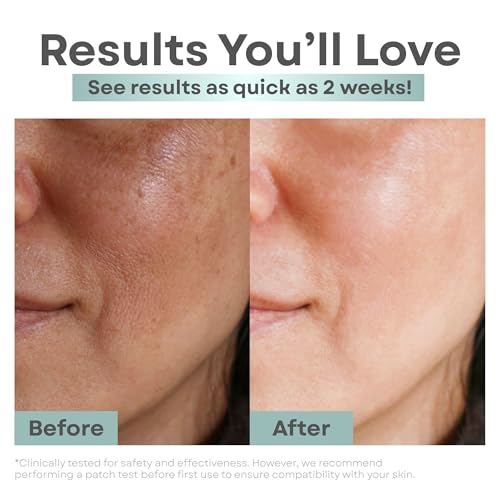 Clear Essence Anti Aging Toner Astringent with Alpha Hydroxy Acid, 8oz, Exfoliating Face Toner for Oily Skin, Acne Prone Skin, Pore Refining & Clarifying Toner for Women & Men, Hydrating Skin Care