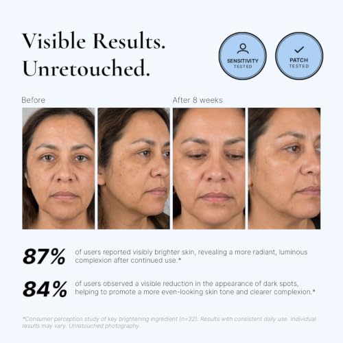 EnaSkin Dark Spot Corrector & Remover Serum for Face & Body, Niacinamide 1 Fl Oz (Pack of 1)