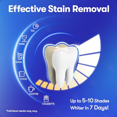 MySmile Teeth Whitening Strips, Hydroxyapatite-Infuse White Strips, Non-Sensitive Teeth Whitening with Soothing Natural Ingredients, Enamel-Safe, Residue-Free, Non-Slip, 21 Treatments Kit 42 Count (Pack of 1)