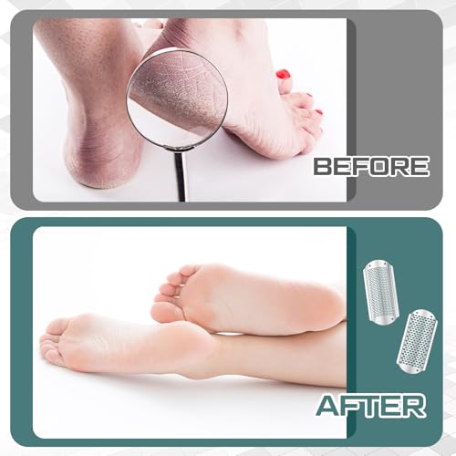 Moxweyeni 14 Pack Colossal Foot File Pedicure Tools Sets with 2 Styles Large and Small Hole Replacement Callus Remover Blades, Stainless Steel Detachable Pedicure Foot Rasp for Dead Skin Remover Silver
