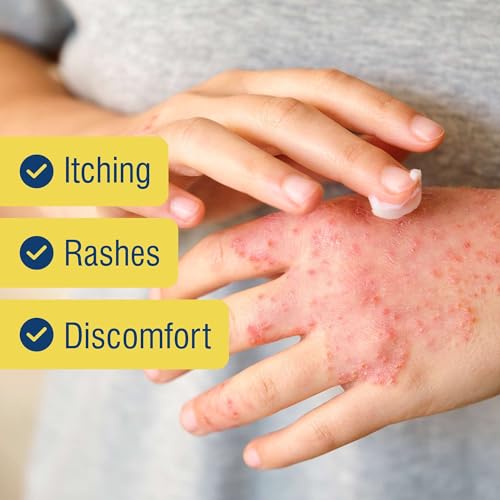 1% Hydrocortisone Cream Maximum Strength - 1 oz of Anti Itch Cream for Itching and Rashes - for Eczema, Poison Plants, Insect Bites, and More 1 Pack