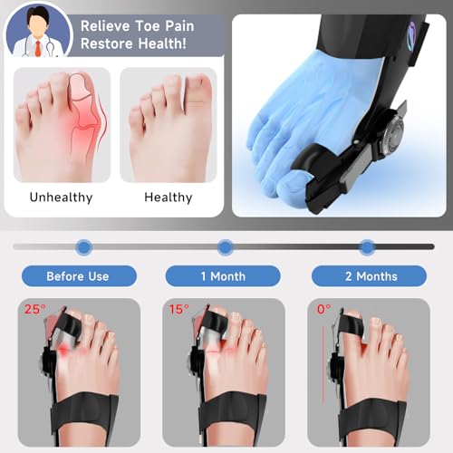 Bunion Corrector for Women & Men, Adjustable Bunion Splint, 1Pcs