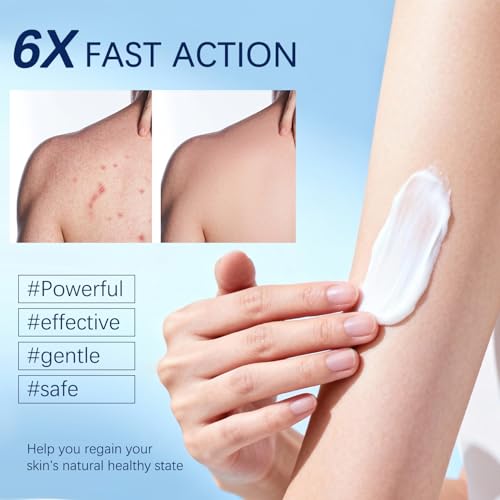 Folliculitis Cream | Soothes & Helps Clear Bumps on Scalp, Face, Body & Butt | for Ingrown Hairs, Razor Bumps & Acne | 120g (01)