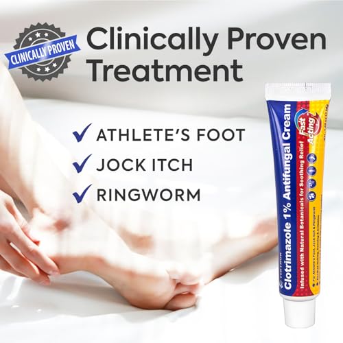 Clotrimazole Antifungal Treatment Cream 30g (1 Pack)