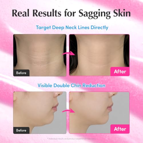 EQQUALBERRY NAD+ Peptide Boosting Serum | 14 Peptide Serum for Face, Neck & Body | Vegan Collagen & Pink Serum for Anti-Aging, Firming & Lifting | Korean Skincare (1.01 oz / 30ml) 1.01 Fl Oz (Pack of 1)