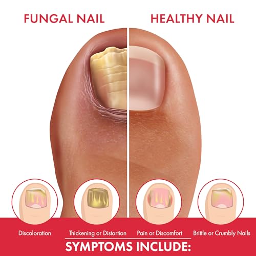 Fungal Nail Renewal 0.43 fl oz – Dermatologist-Tested Brush-On for Nail Discoloration, Thickening & Brittleness – Hydrates & Smooths Nails