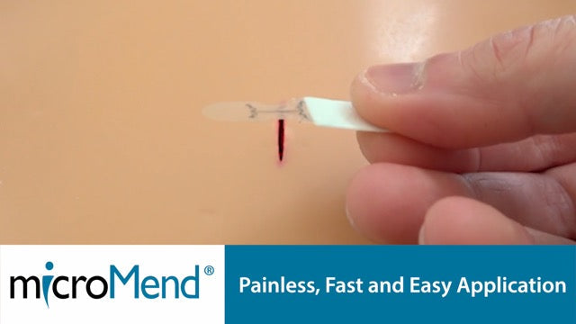 Emergency Wound Closure Kit - 6 Sterile Laceration Strips 6 Closures