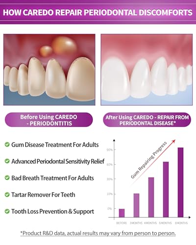 CAREDO Gum Repair & Tooth Restoration Toothpaste Set, Hydroxyapatite Fluoride Free Toothpaste for Receding Gums, Periodontitis, Root Canal Discomfort & Pulpitis Relief, for Sensitive Teeth, 2-Pack