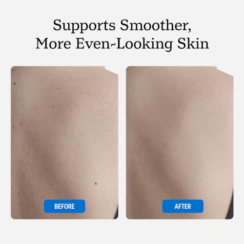 NUVADERMIS Restorative Body Oil for Scars, Stretch Marks & Dry Skin | Argan Oil, Rosehip Oil & Vitamin E | Lightweight, Fast-Absorbing Body Oil | 3.4 fl oz