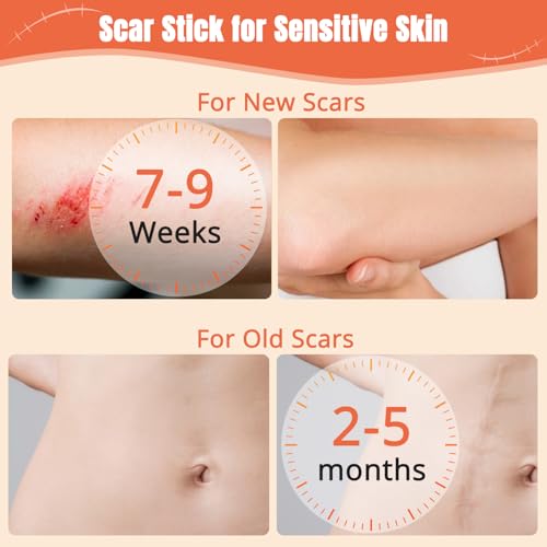 2Pcs Silicone Scar Stick, 60% Scar Solutions for Face and Body Skin, Gentle Ingredients on All Skin Types, Lightweight & Easy to Apply