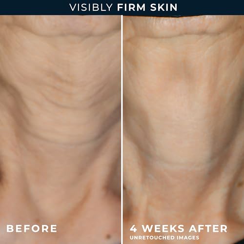 RoC Crepe Repair Face & Neck Firming Cream 1.7oz, Retinol + Hyaluronic Acid 1.7 Fl Oz (Pack of 1)