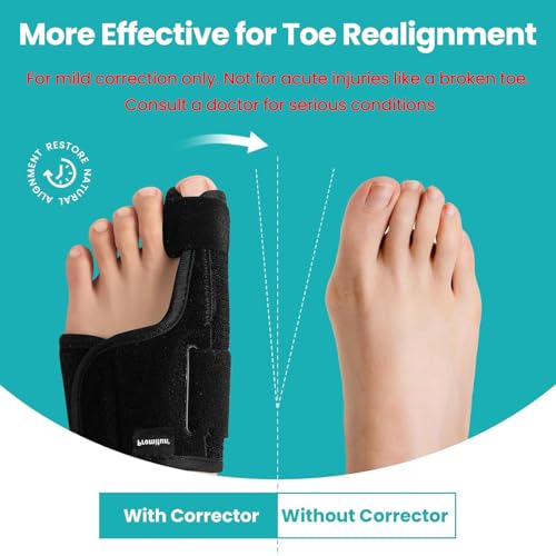 Promifun Toe Splint for Broken Toes - Big Toe Splint for Women & Men - Support Brace for Day & Night Use - Bunion Corrector - 1 Pair Black