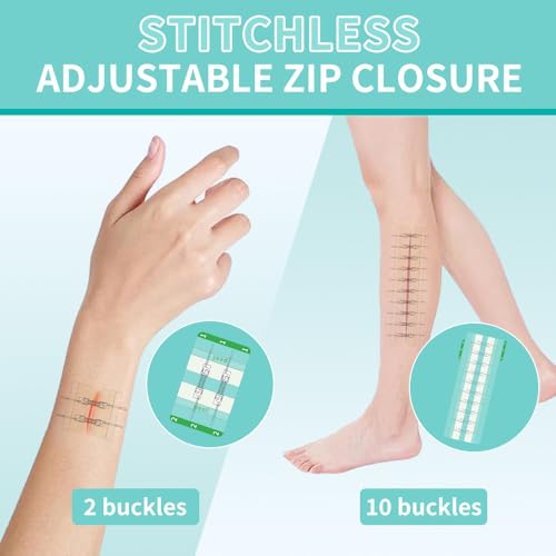 Hydrocolloid Wound Zipper Wound Closure Strips Zip Stitch Sutures Butterfly Bandaids Emergency Laceration Closure Kit for Lacerations Incisions Cuts（5x7cm）