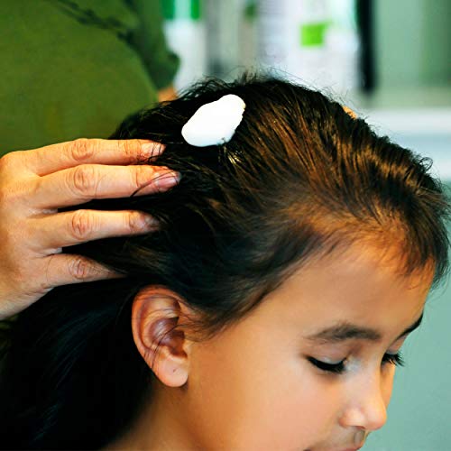 My Hair Helpers Natural Enzymes Head Lice Mousse, 4 fl oz 4 Fl Oz (Pack of 1)