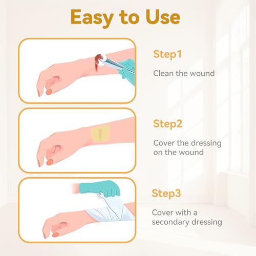 Jointown Xeroform Petrolatum Dressing Bandages, Soft Mesh Gauze Patch for Wound Care, Burns, Lacerations, Skin Grafts & Surgical Incisions, 4"x4", 25 Individual Pack 4"×4"