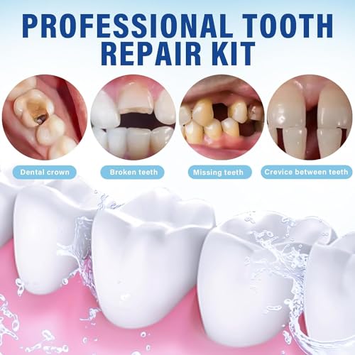 Tooth Repair Kit, Temporary Teeth Replacement Kit, Zinc Oxide Eugenol Cement Dental Kit for Broken Chipped Teeth, Missing Teeth, Crown Fillings & Bridges, Improving Smile 4 Pcs