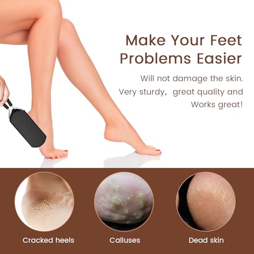 Colossal Foot Rasp Scraper - Callus Remover Detachable Big Hole 1 Count (Pack of 1)