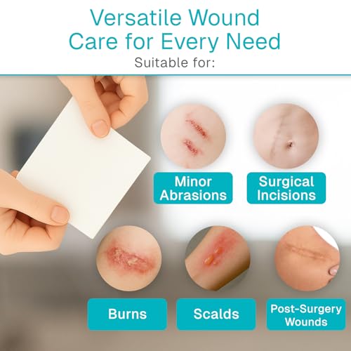 ViveCare Gelling Fiber Wound Dressing - Sterile, Gentle Care & Highly 2”x2” 10.0