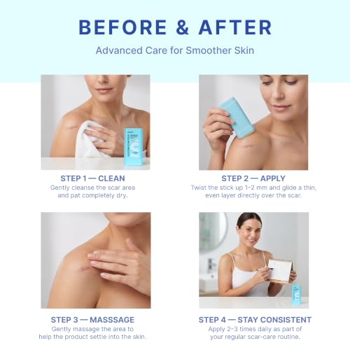 Suquato Silicone Scar Stick – Silicone Keloid Scar Removal Cream for Face & Body, Helps Improve Surgical Scars, C-Section, Acne Scars & Stretch Marks, Portable Twist Stick– 20g