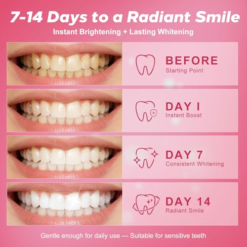 Professional Teeth Whitening Kit with 5 Teeth Whitening Gel