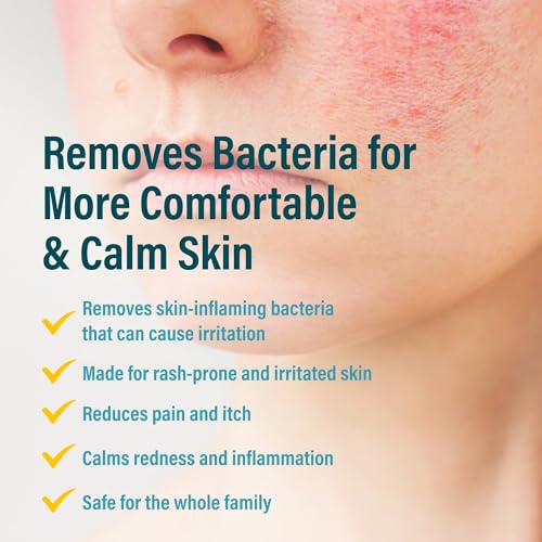 A+D Advanced Dermatitis Hypochlorous Acid Spray, for Face & Body, 4 oz