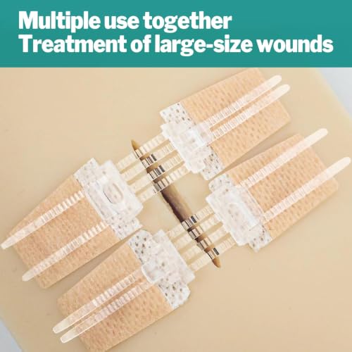 AZEN 10 Pack Emergency Wound Closure Strips, Butterfly Bandages, Laceration Closure Zip Stitch, Repair Wounds Without Stitches 10P (1tie)