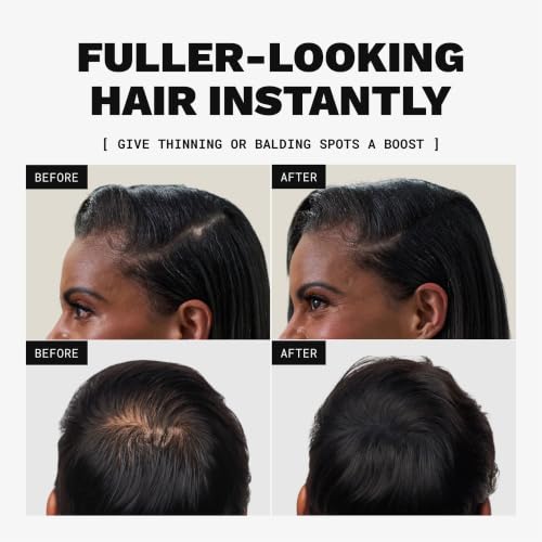 Toppik Hair Building Fibers, Fill In Fine or Thinning Hair Instantly Thicker, Fuller Looking Hair 9 Shades,4 size options Black Medium 12g