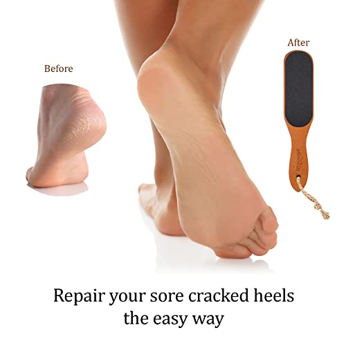 Pumice Stone Foot File - Wooden Pedicure Feet Scrubber with Handle for Callus, Dry, and Dead Skin Removal - Heel Scraper for Feet, Hands, and Body - Foot Filer for Use in Shower Brown 1 Count (Pack of 1)