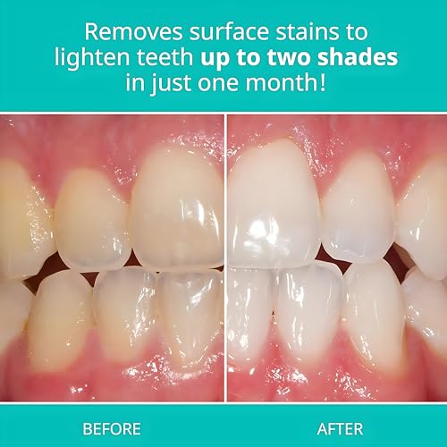 Opalescence Whitening Toothpaste, Travel Size 1 Ounce (6 Pack) Fluoride Teeth Whitening Toothpaste Travel Size, Original Mint Flavor, 402-6 1 Ounce (Pack of 6)