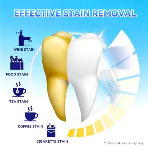 Teeth-Whitening Strips for Sensitive Teeth - Teeth Whitening Kit Professional Effects, Teeth Whitener for Enamel Safe, 14 White Strips (7 Day Treatment) Remove Stains for a Brighter Smile, Mint 14 Count (Pack of 1)