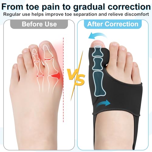 1 Pair Bunion Corrector for Women & Men, Big Toe Straightener for Hallux Valgus Pain Relief & Toe Alignment, Soft and Breathable for Day/Night, Wide Non-slip Strap, Include a Massage Ball (Black) Black