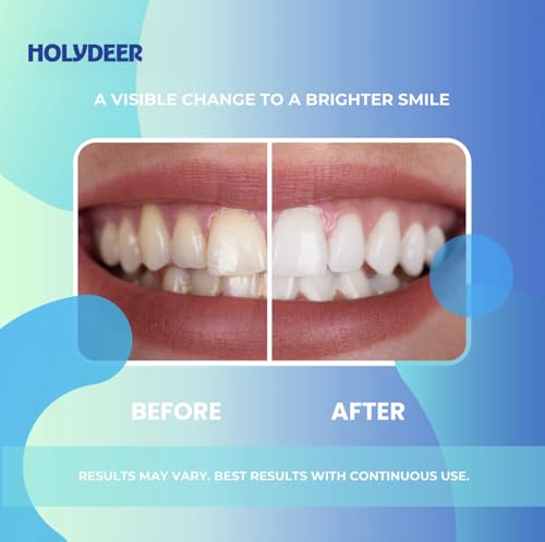 Nano-Hydroxyapatite Toothpaste, Mint, 7.5% nHAP, Fluoride-Free, Sensitive Whitening, Enamel Strengthening, 4.23 oz 3PK Blue 4.23 Ounce (Pack of 3)