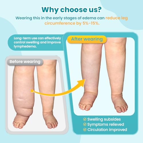 Sylong® Swelling Edema Calf & Foot Compression Wrap Adjustable Sleeve For Lower Leg and Foot Lymphedema Circulation (XL) XL